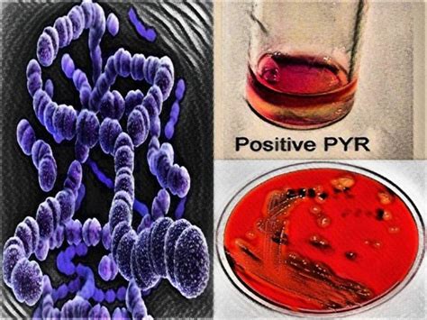 Various Biochemical Tests for Streptococcus pyogenes.